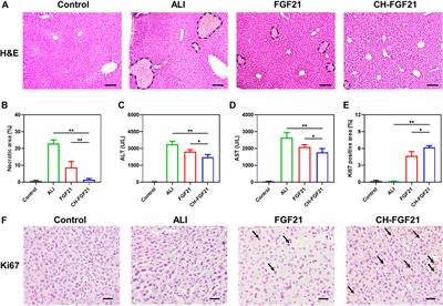 Self-assembled FGF21 nanoparticles alleviate drug-induced acute liver injury